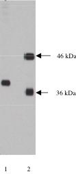 "
Lane 1. Western blot using anti-NPDC-1 (Cat # X1727M) on 10 µg lysate transfected with NPDC-1 protein at a dilution of 1µg/ml, detected with Supersignal West Pico Substrate, 15 second exposure. Lane 2 probed with anti-Rem and anti-alpha SNAP antibodies. "